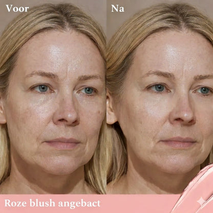 Milano Oogcontour Verhelderaar